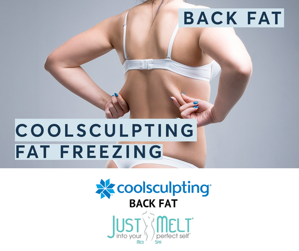 CoolSculpting for Lower and Upper Back Fat in NYC - Just Melt Med Spa
