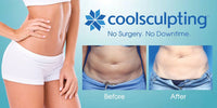 Benefits of Getting Coolsculpting for the New Year